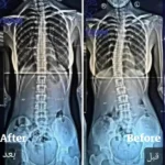 Boston Brace - Image 2