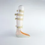 PTB Weight Bearing Orthosis - Image 3