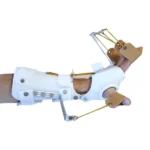 Radial Palsy Splint